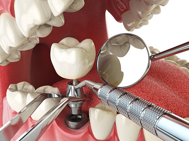 Best Emergency Dental Care for Trauma or Injury in Fairmont City, IL